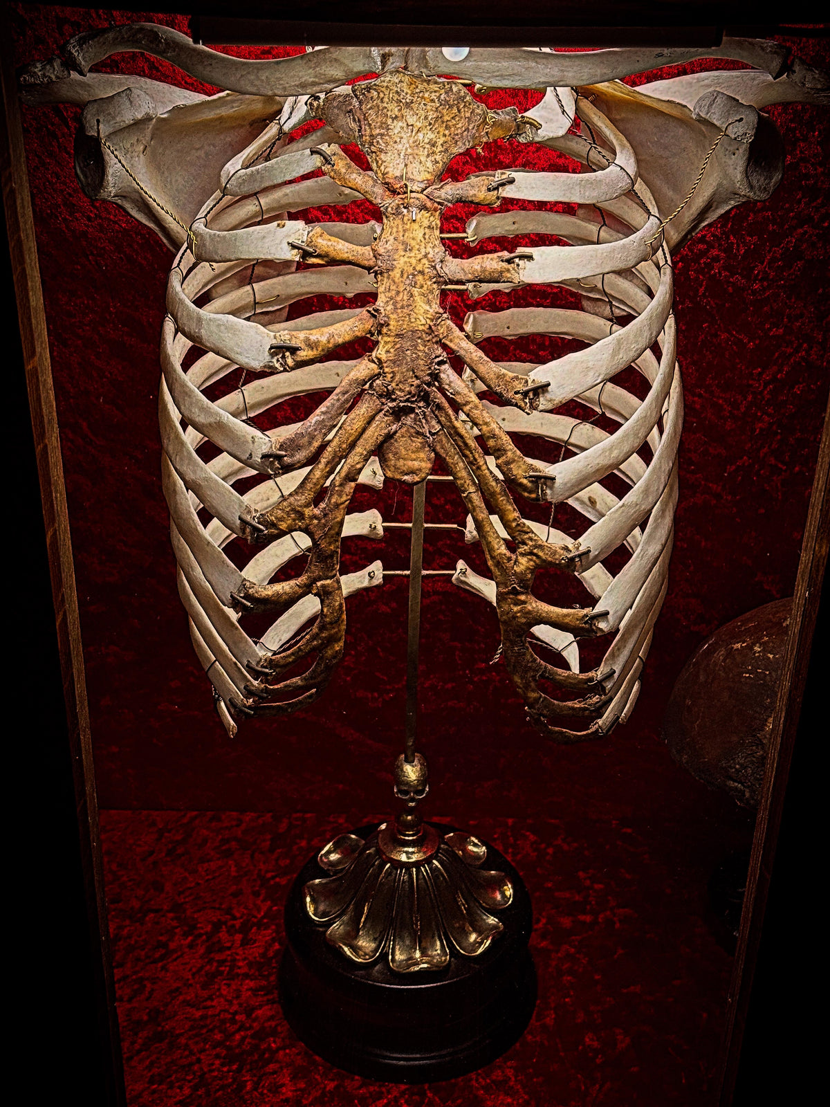 Antique Human Torso