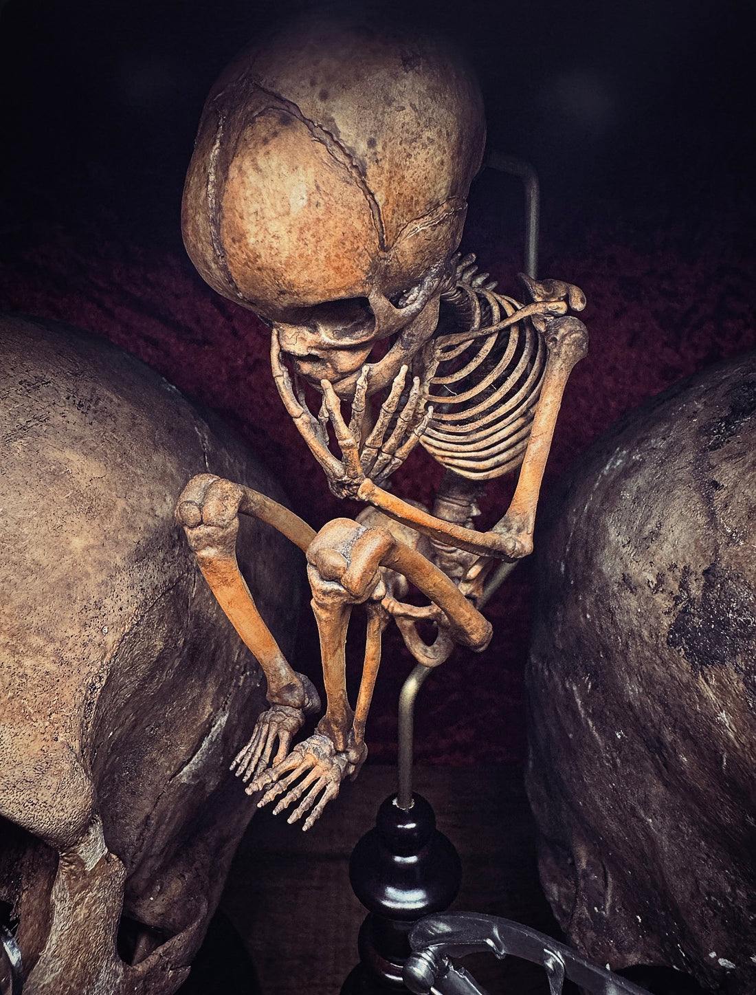 fetal Specimen